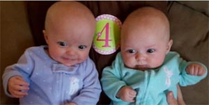 Twins 4 months